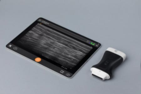 New Clarius Wireless Ultrasound 