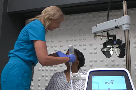 Sustained Dry Eye Relief Achieved with Tixel® Treatment