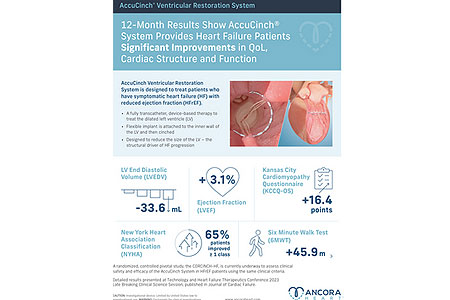 Ancora Heart’s AccuCinch System Demonstrates Significant Improvement in Quality of Life