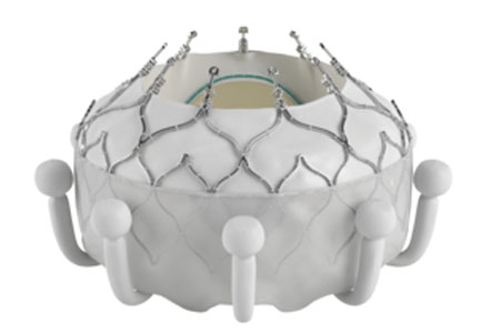 Edwards’ EVOQUE Valve Replacement System First Transcatheter Therapy to Earn FDA Approval for Tricuspid Valve
