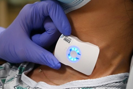 FloPatch Wearable Doppler Ultrasound Receives Vizient Innovative Technology Contract from Flosonics Medical
