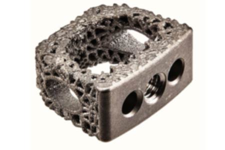 Flux-C 3D printed porous titanium cervical interbody 